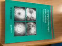 Angiografia fluoresceinowa i indocyjaninowa  Berkow Misiuk-Hojło