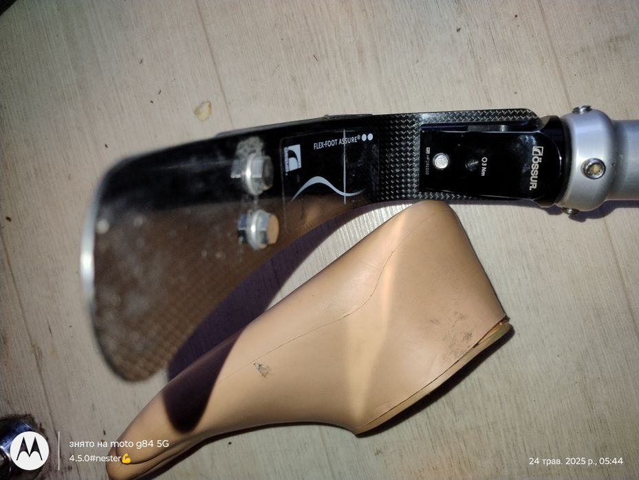 Протез стопа. Права