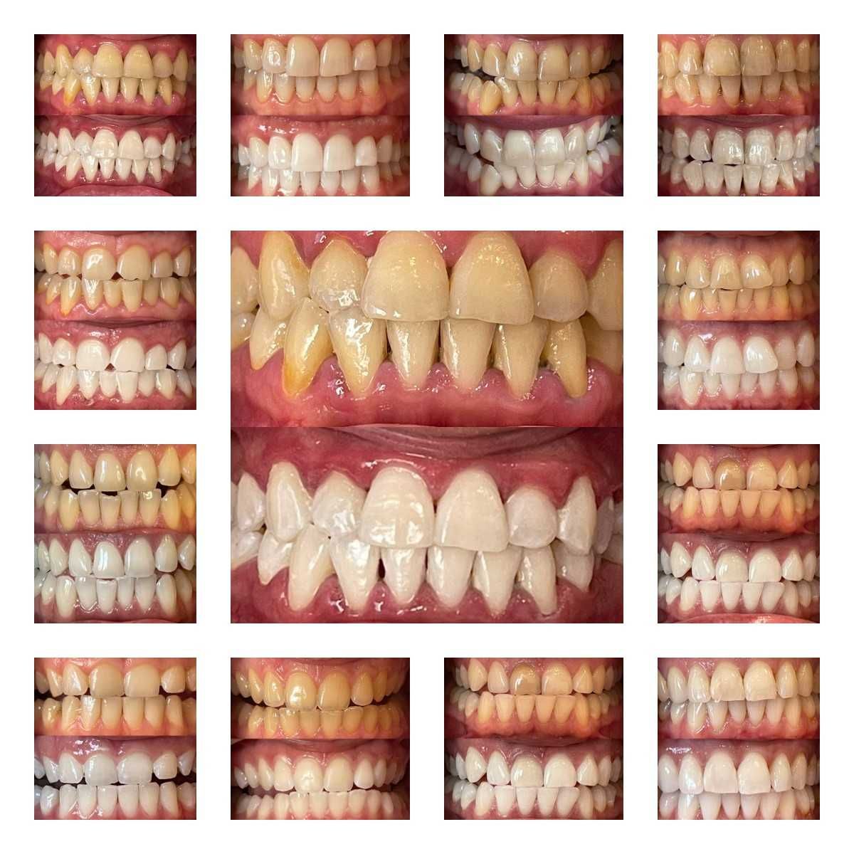 Франшиза сети студий косметического отбеливания зубов Smile LAB