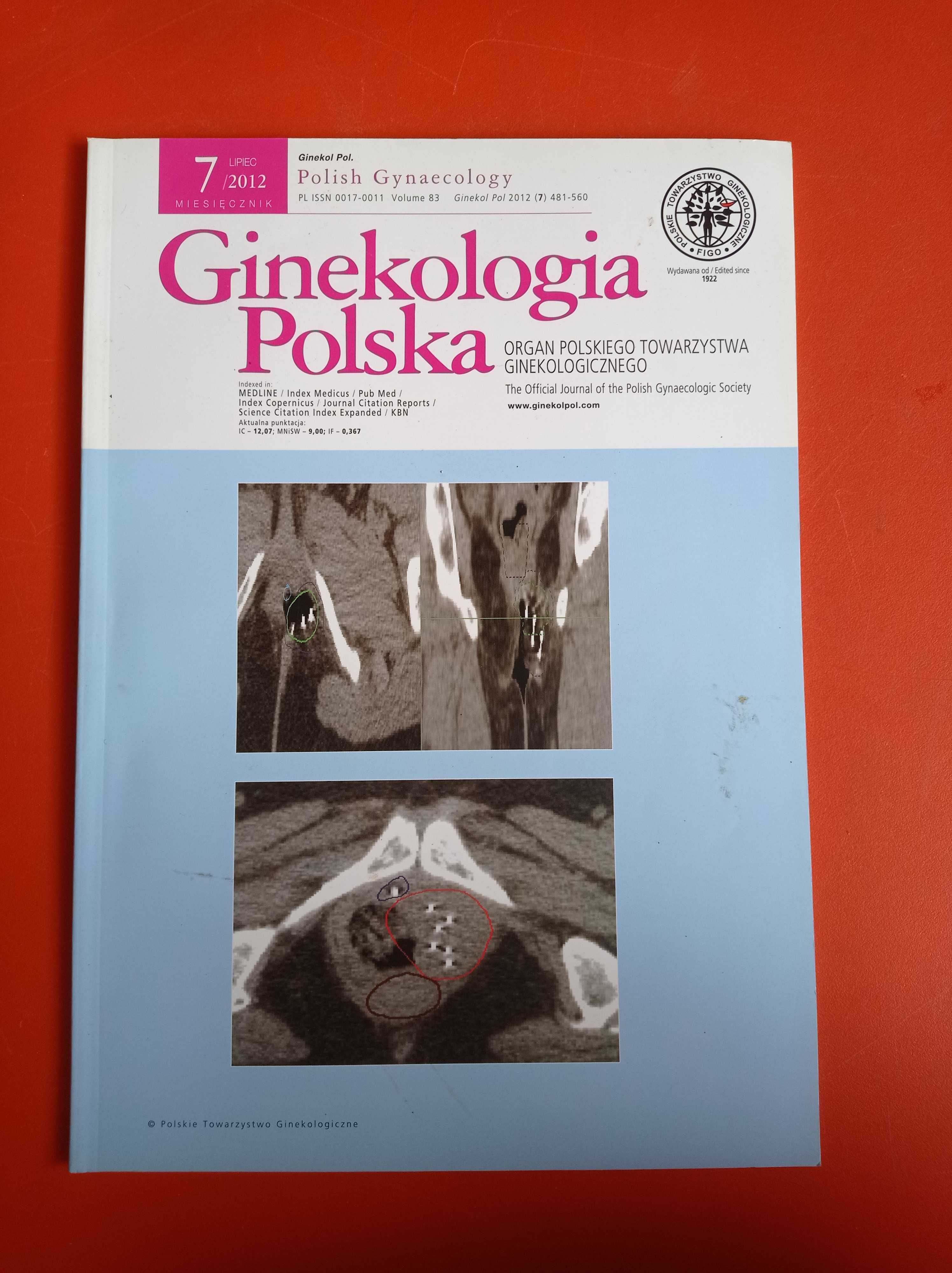 Ginekologia Polska, nr 7/2012, lipiec 2012