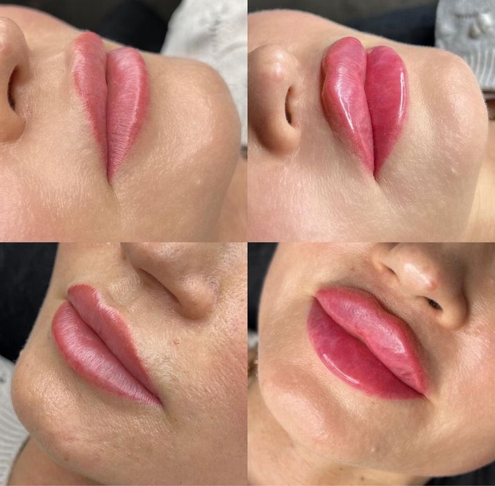 Увеличение губ, 1500 грн, топ техника!