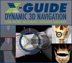 Aparelho de cirurgia Navegada X-Guide