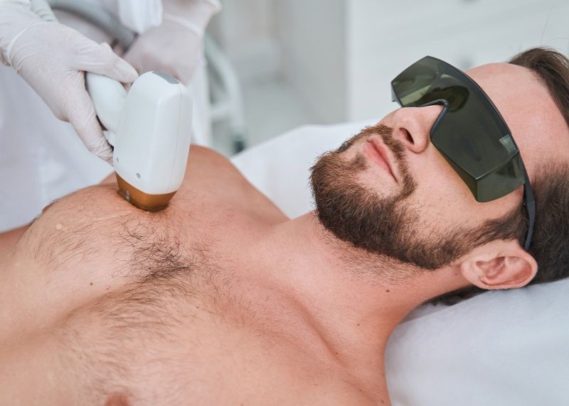 Depilação a laser