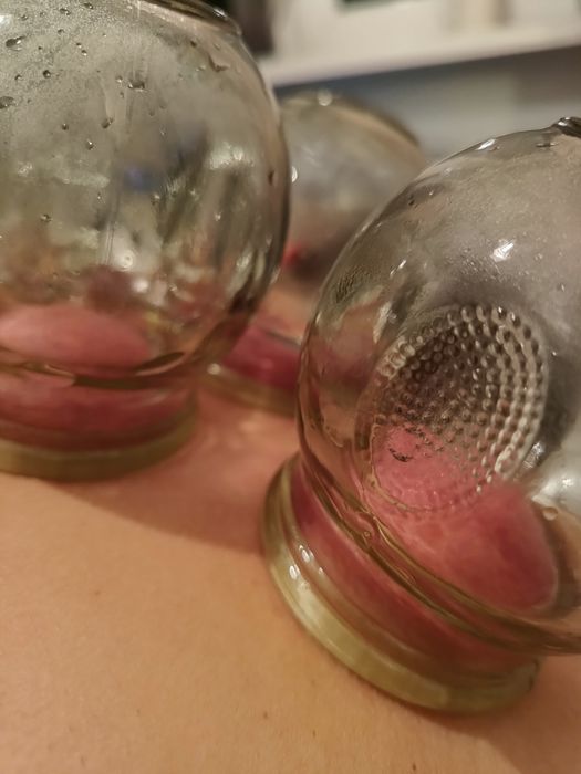 Stawianie ogniowych baniek lekarskich z dojazdem