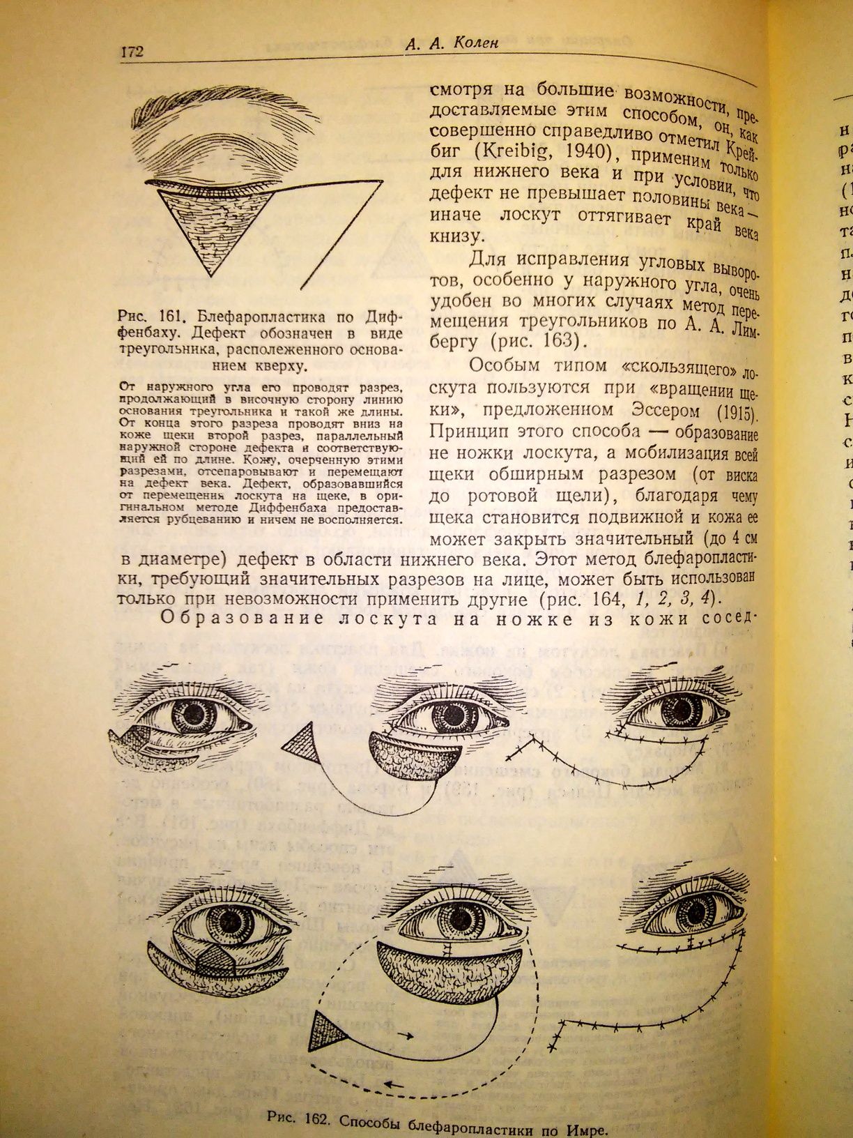 Плетнева Хирургия вспомогательных органов глаза 1959