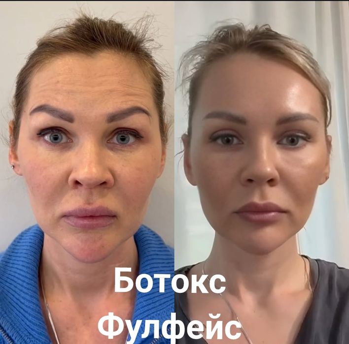 Услуги косметолога