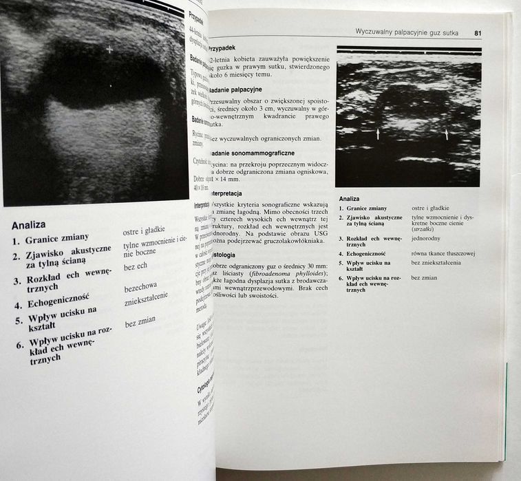 Atlas ultrasonograficzny sutka, Leucht, Madjar, UNIKAT!