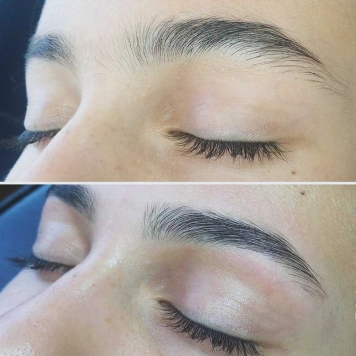 Депіляція, метро Дарниця,Воскресінка,Троєщина,Лівий берег