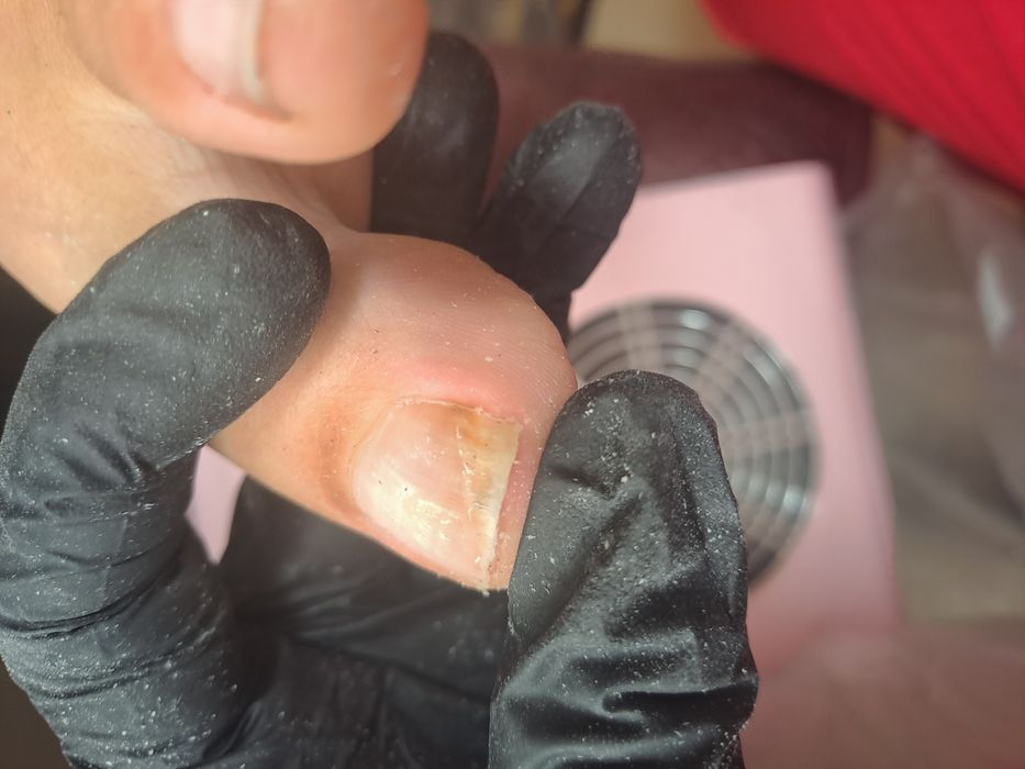 Апаратний педикюр з основами подології в місті СУМИ