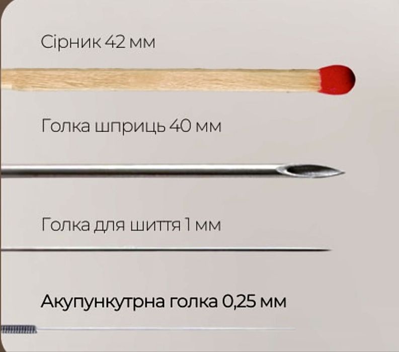 Голкотерапія.Акупунтура . Зменшення болю в спині