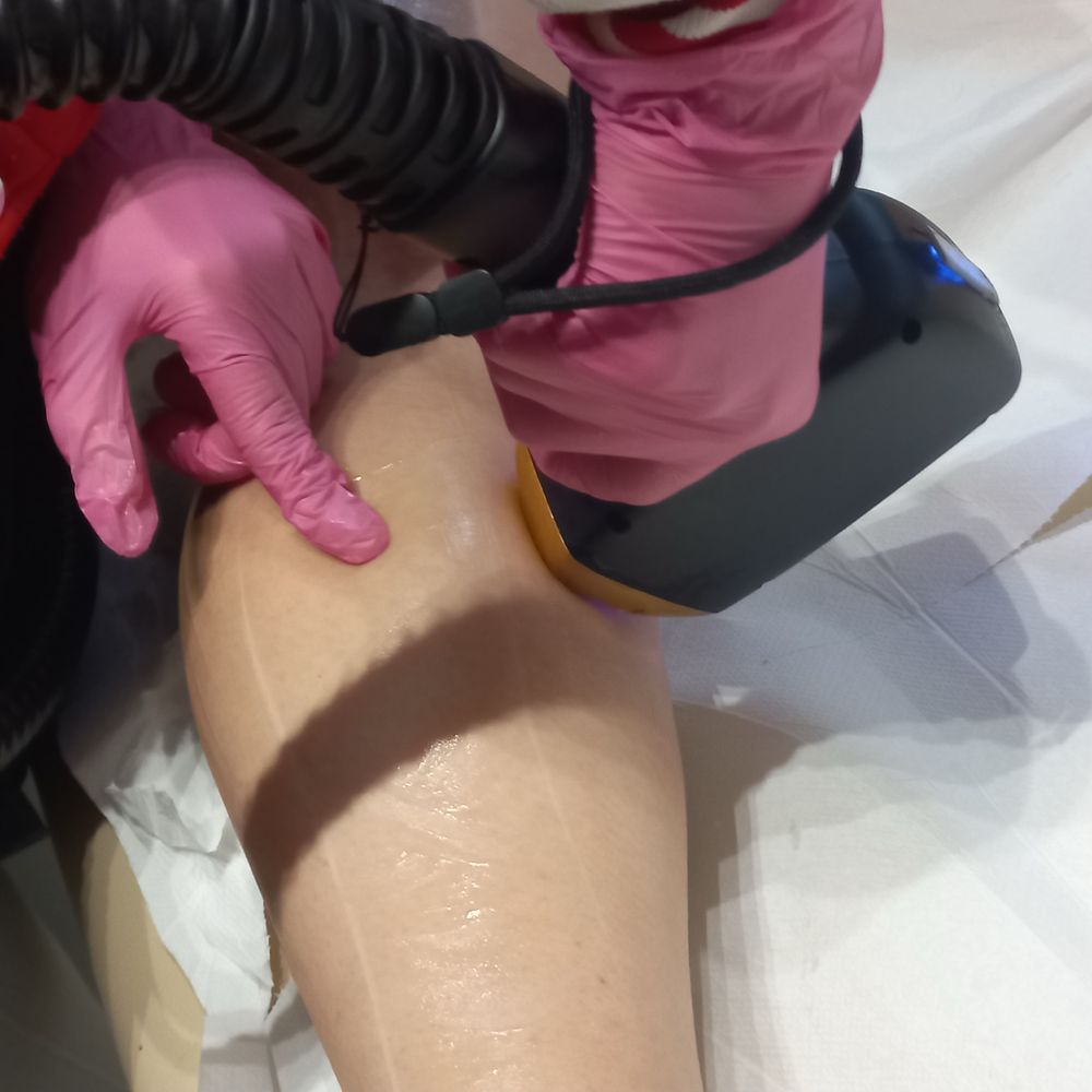Masaż ciała.DEPILACJA  laserowa, pasta cukrowa PEELING. Bielsko Biała