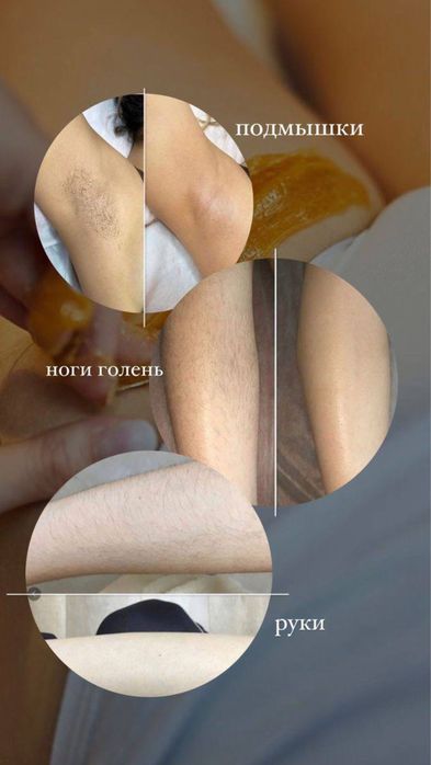 Шугаринг и восковая депиляция