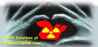 Blindagem Radiologica rolo de chumbo 1,5 mm preço/kg