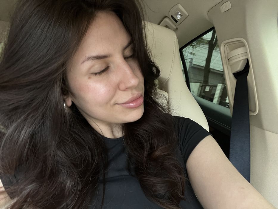 Модель на контурна пластика Губ/збільшення губ|Ботокс|Косметолог Одеса