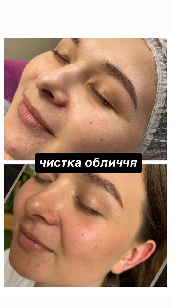 КОСМЕТОЛОГ ЛЬВІВ | МАСАЖ обличчя, чистка, пілінги