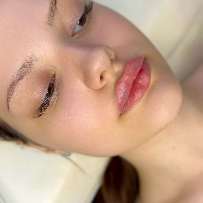 Модель на губы  ботокс Угли Джоли скули