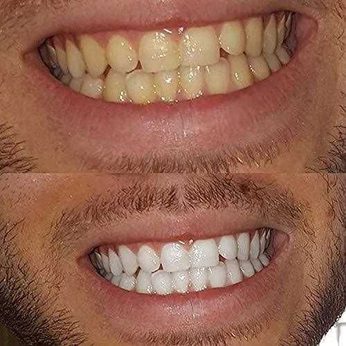 Branqueador de dentes + escova natural