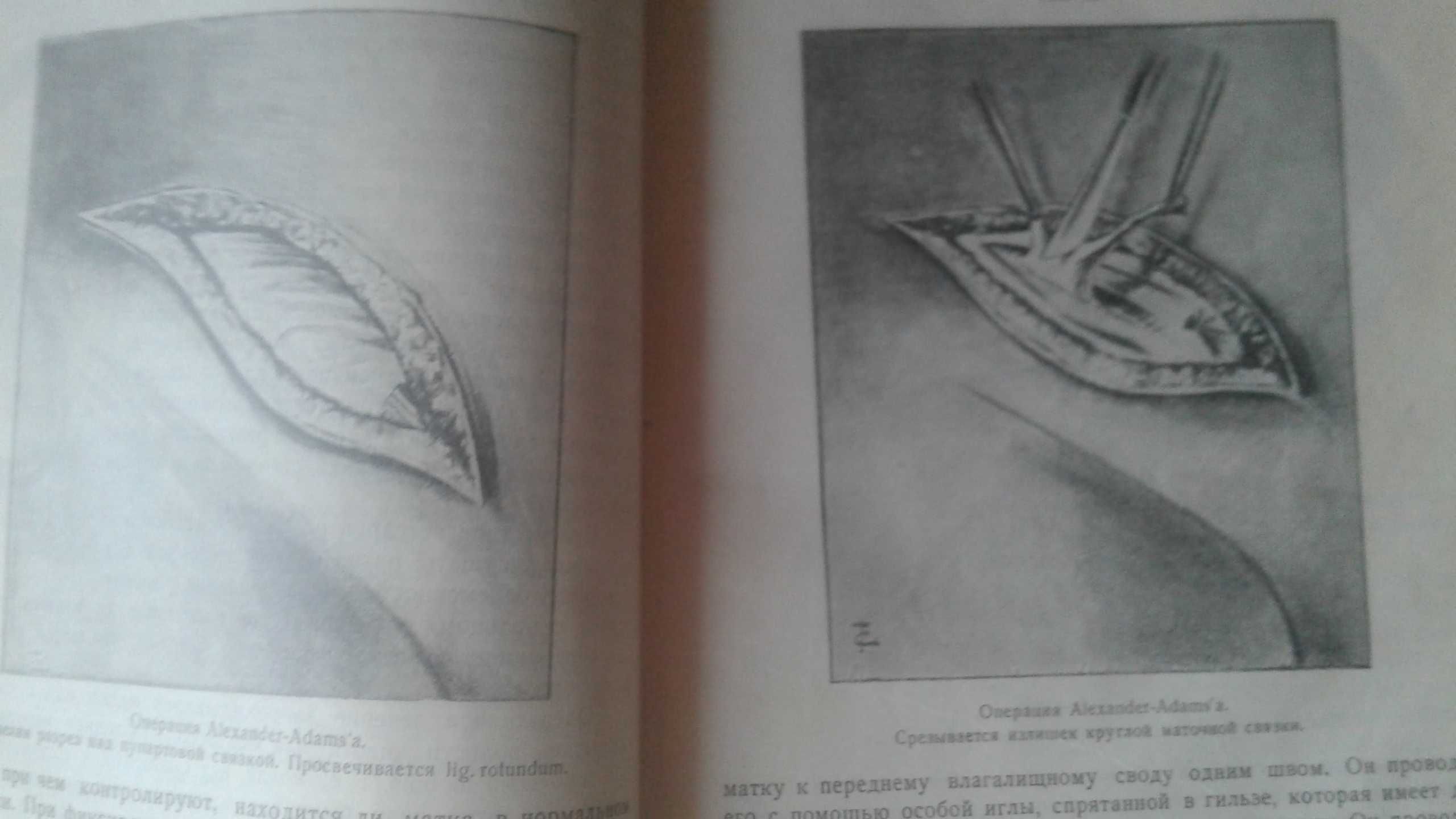 Женские болезни Одесса 1923 год. Проф. Орлов гинекология антикварная