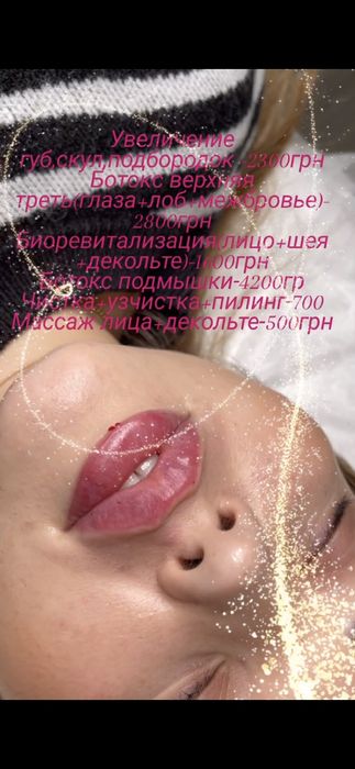 Косметолог,увеличение губ ,ботокс ,чистка лица ,пирсинг,мезотерапия