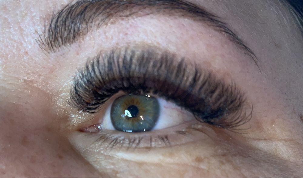 Електроепіляція, шугаринг,лазерна епіляція