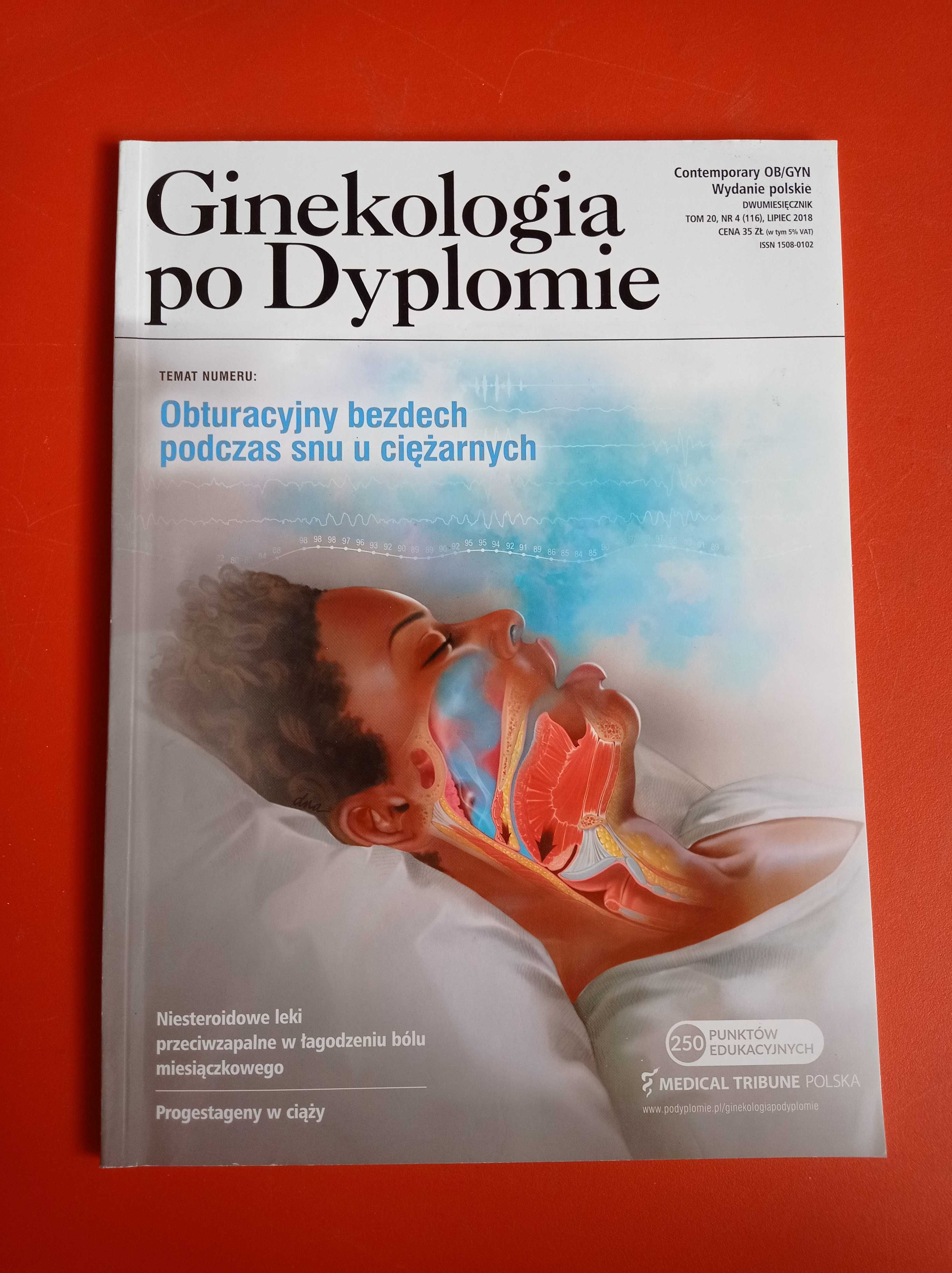 Ginekologia po dyplomie, nr 4, tom 20, lipiec 2018