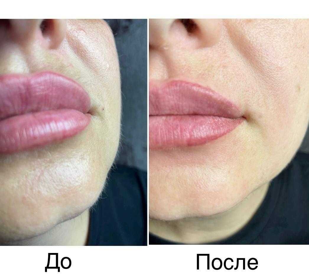 Шугаринг/депіляція воском
