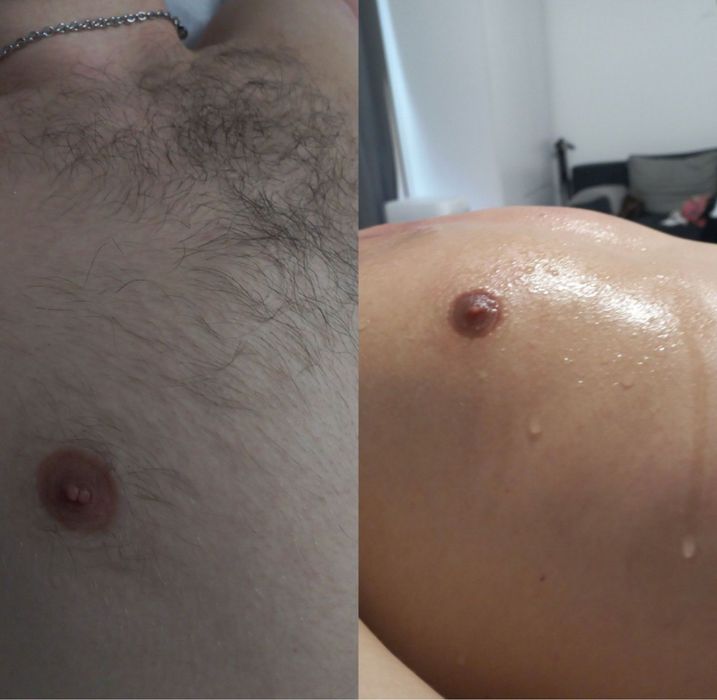 Депіляція чоловіча, жіноча, шугаринг