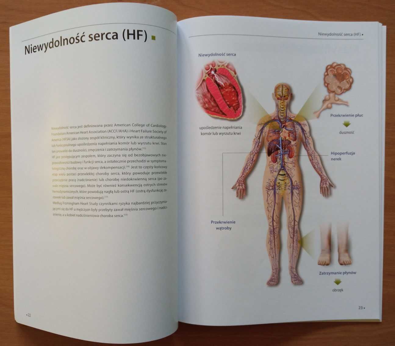 Nowy: Atlas niedokrwistość i niewydolność serca - Luis Lepori 2023