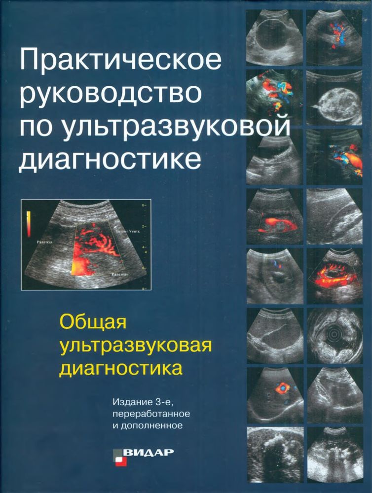 Практическое руководство по ультразвуковой диагностике. Митьков