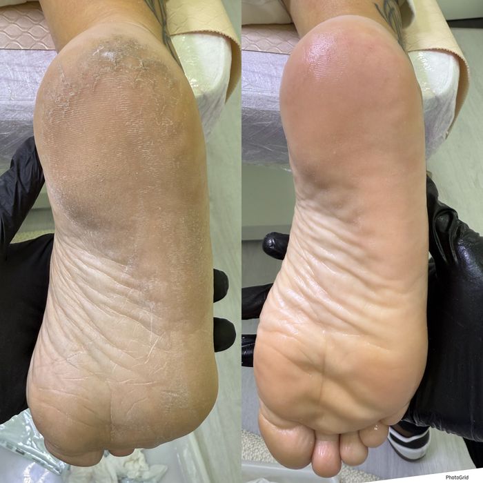 Podologia Técnica a domicilio