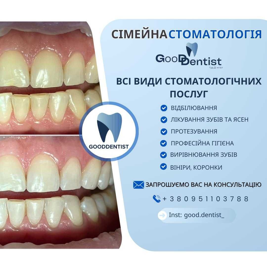 Прийом Лікаря Стоматолога Троєщина