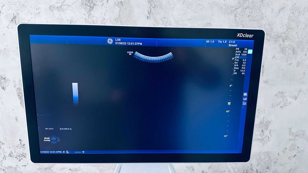 УЗД GE LOGIQ S8 XDclear 2.0 + 3 датчика  (2016 р.в.)