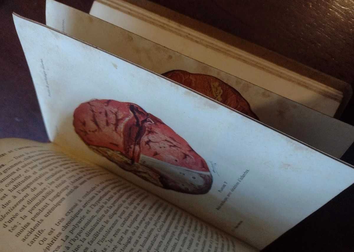 Précis de Pathologie Interne I - F. J. Collet 1914