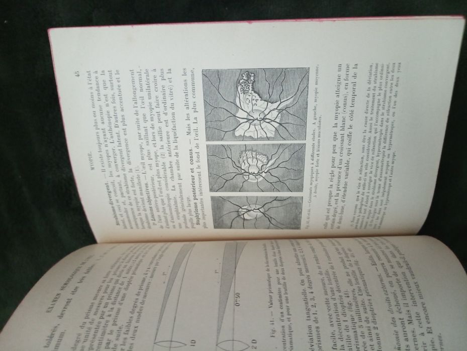 Ophtalmologie - Félix Terrien 1914 !! Bibliothèque du Doctorat en Méd*