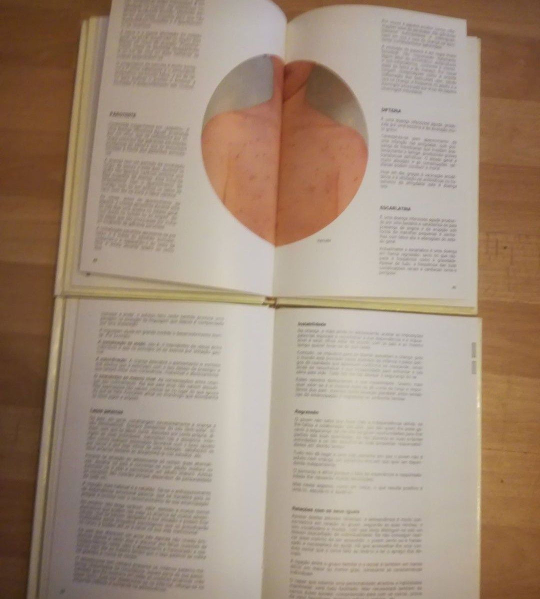 4 livros de Puericultura
