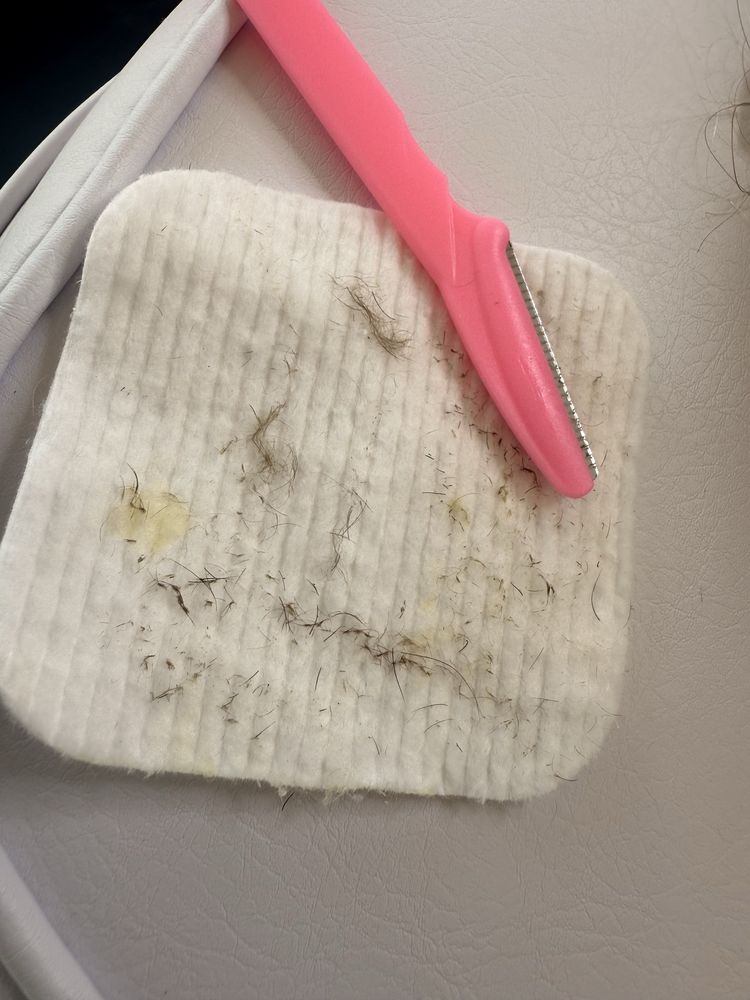 Limpeza de pele profunda