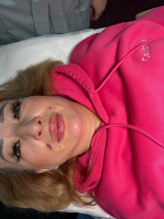 Пошук моделей на губи та ботокс