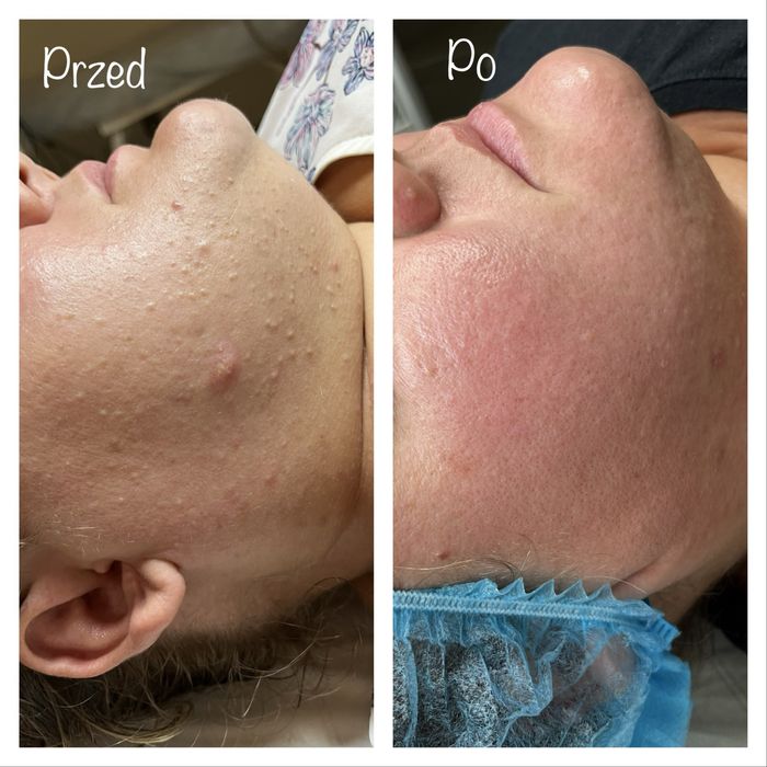 Makijaż permanentny brwi