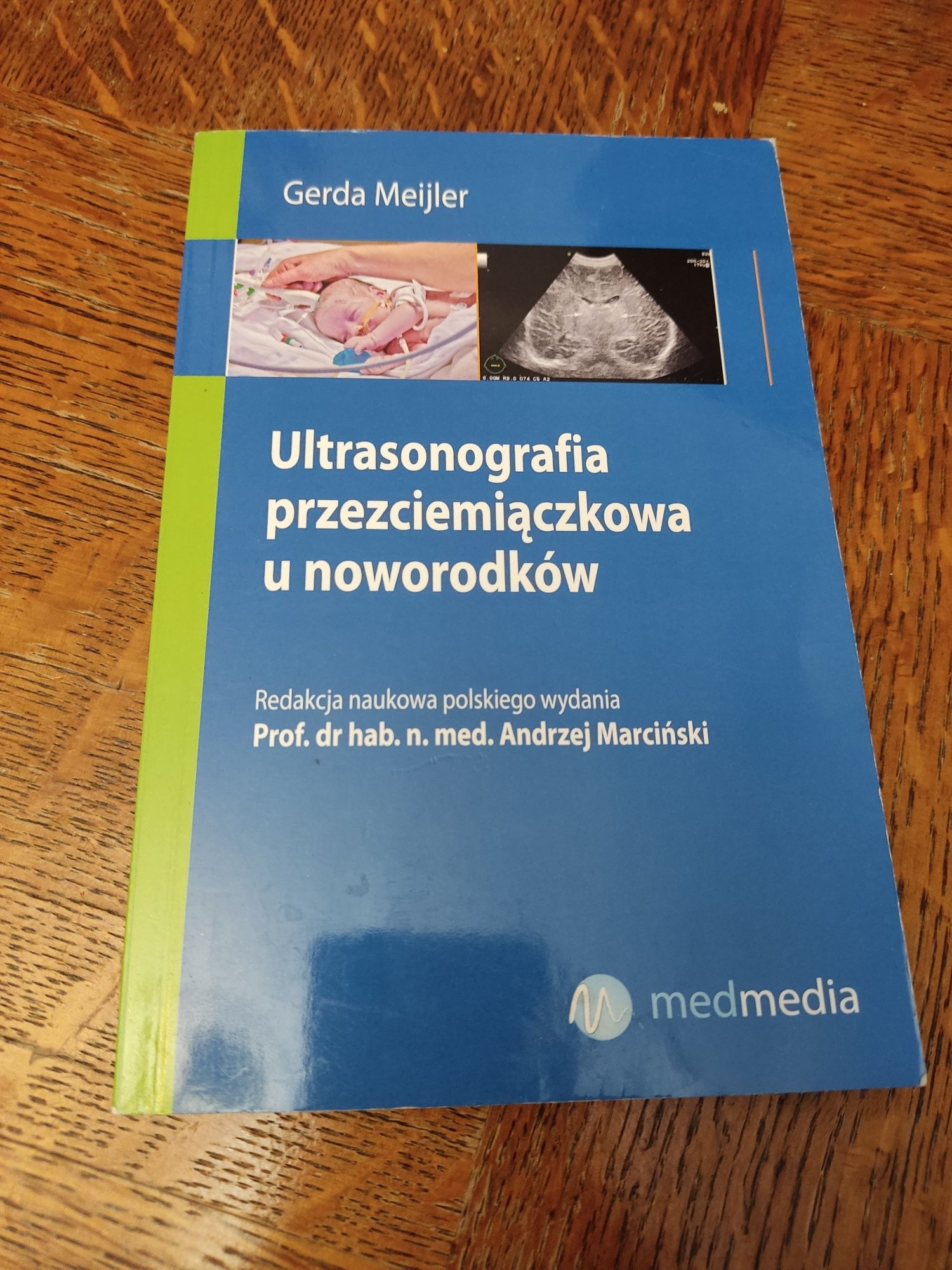 Ultrasonografia przezciemiączkowa u noworodków USG Marciński Andrzej