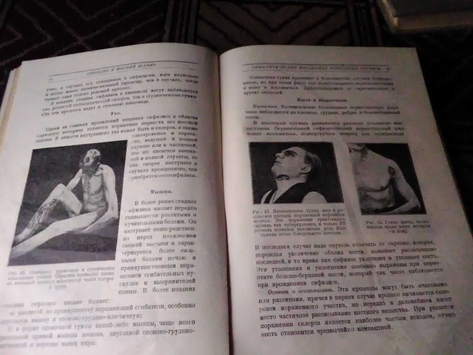 Венерические заболевания 1930 год.