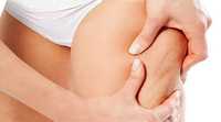 Антицелюлітний  масаж 300 грн  1 година