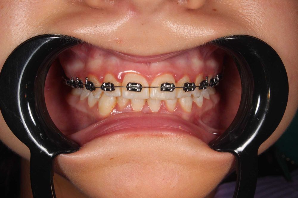 Ортодонт. Діти та дорослі: діагностика, планування, лікування