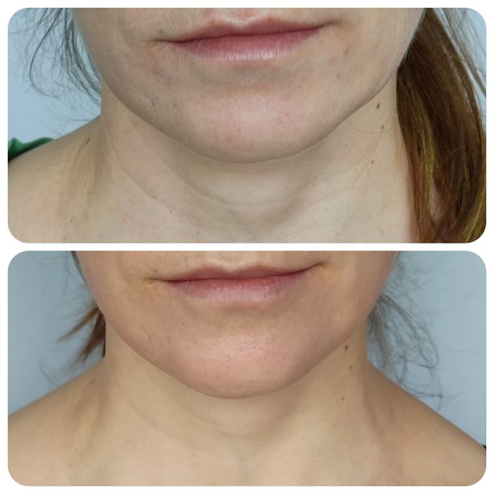 Масаж обличчя професійно