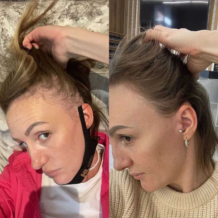 Occuba Сыворотка против выпадения волос