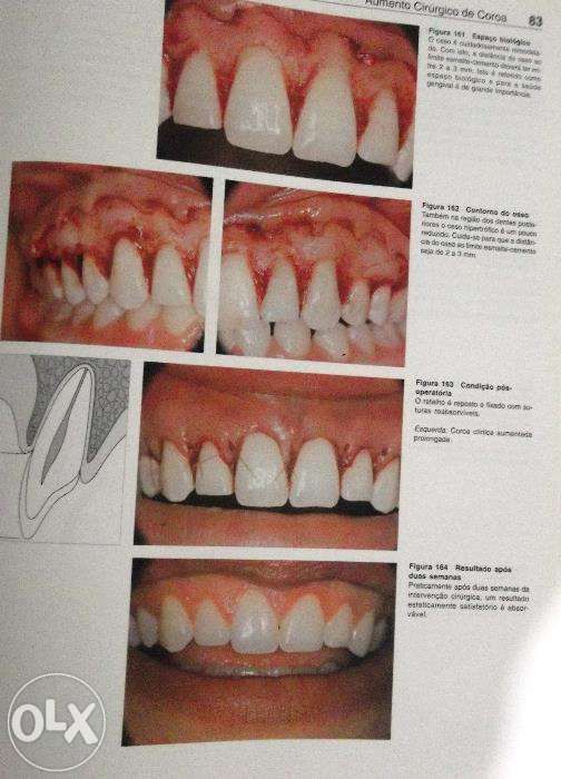 Odontologia Estetica-Atlas colorido