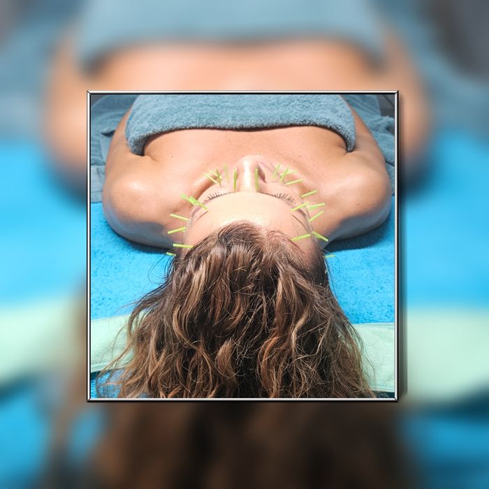 Naturalna Medycyna Estetyczna - akupunkura, masaże twarzy