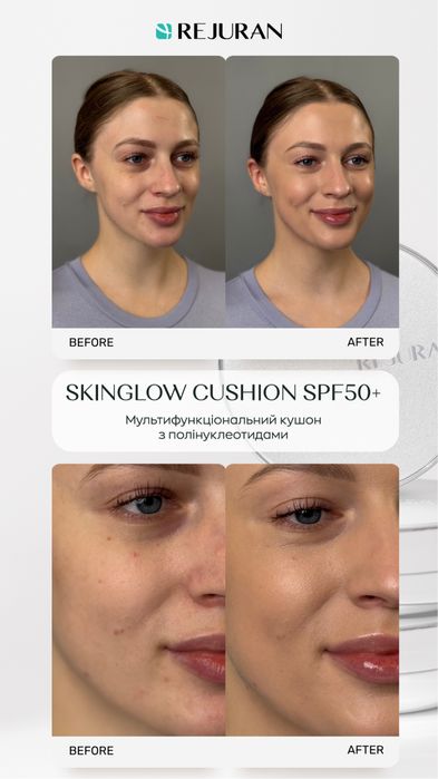 Rejuran Cushion —кушон з доглядовими компонентами