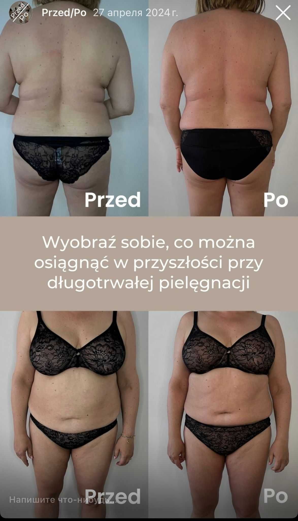 Urządzenie do masażu modelującego sylwetkę Vela Shape