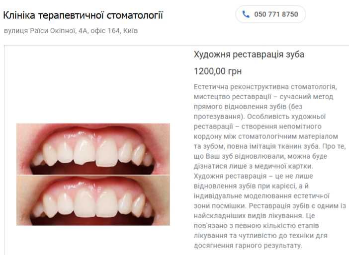 Стоматологія Київ Пломба фотополімерна недорого 599 грн. Пломба на зуб