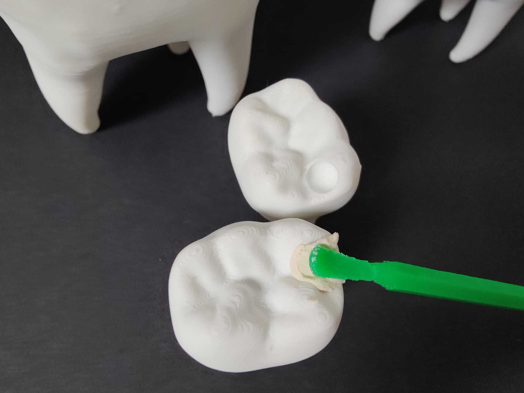 ZĄB MAŁY UBYTEK DO UZUPEŁNIENIA- ząb warsztaty stomatologiczne